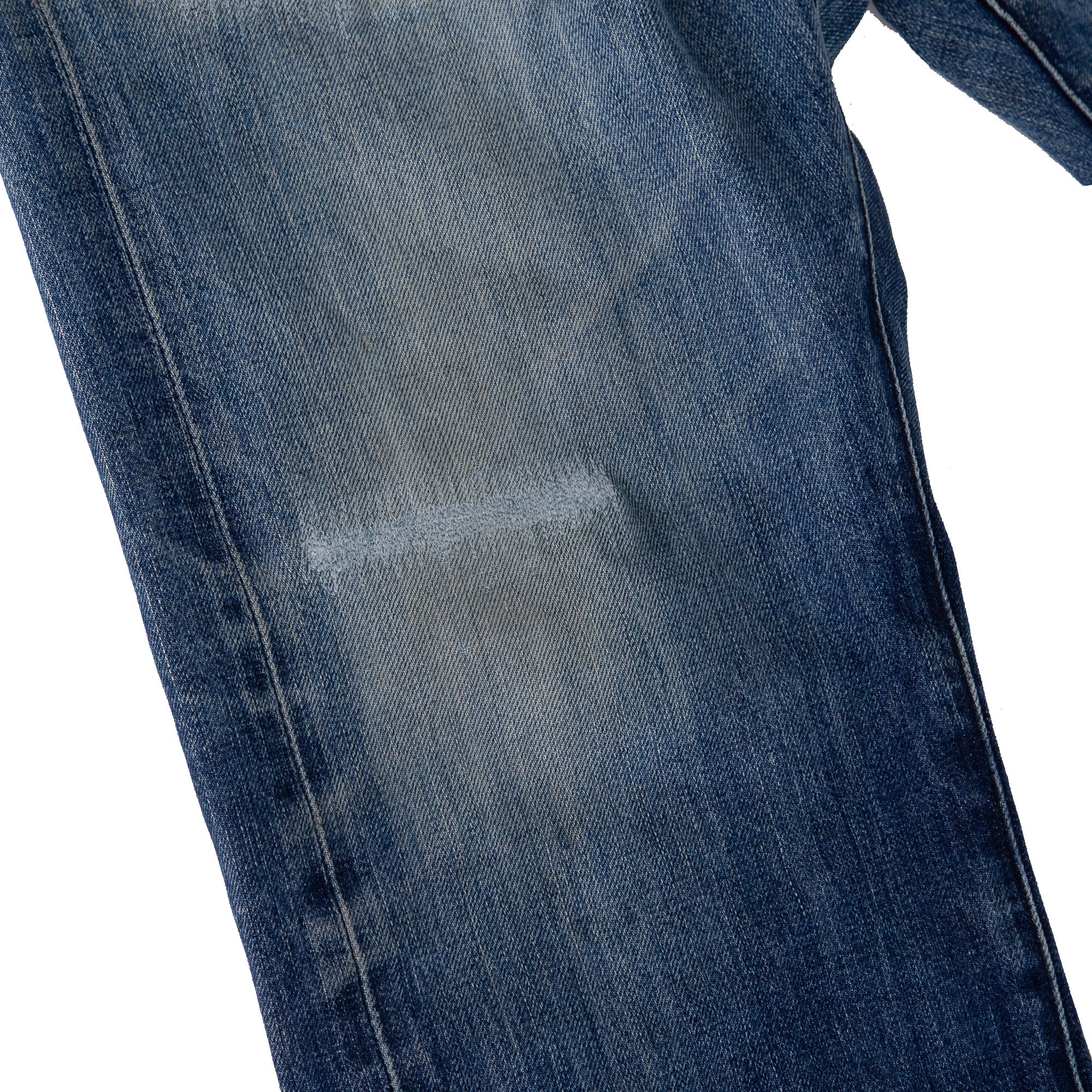 After Photo of Knee Repair for Knee Repair Service