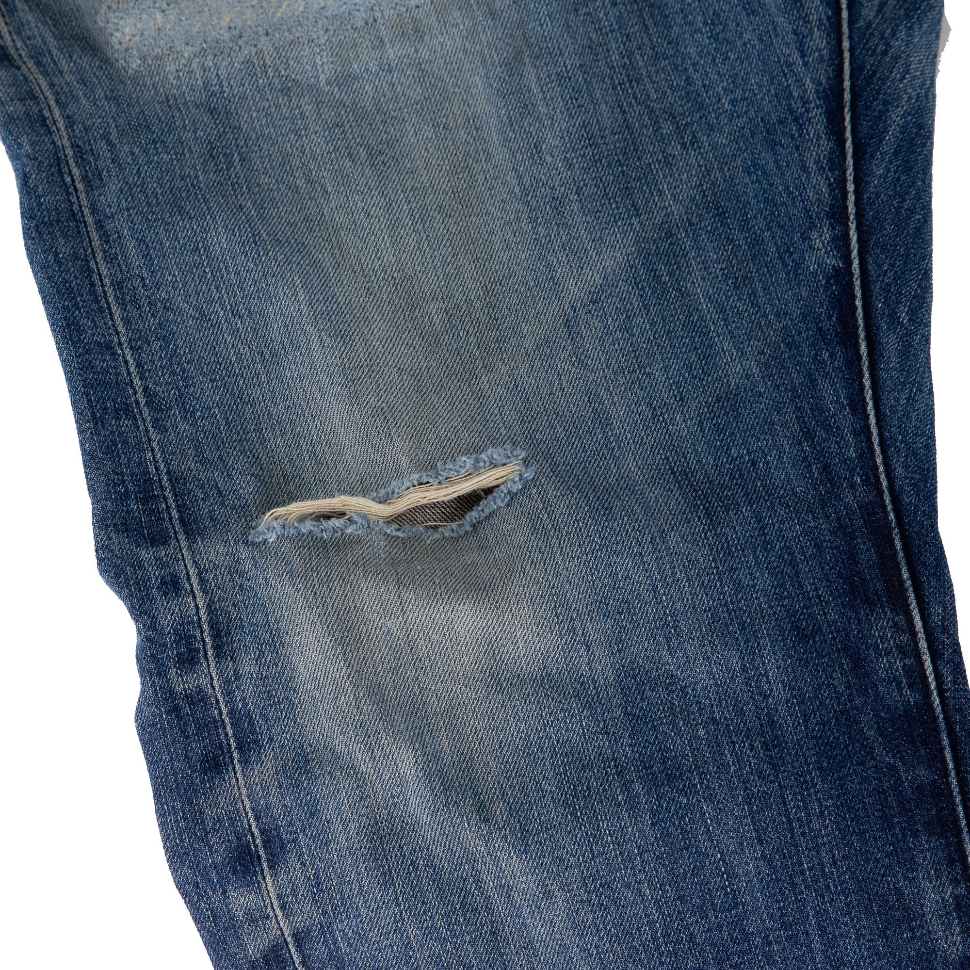 Before Photo of Knee Damage for Knee Repair Service